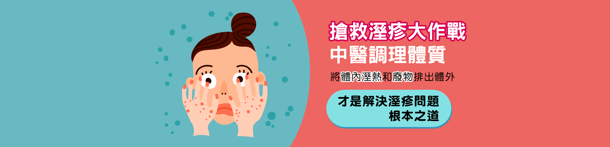 溼疹